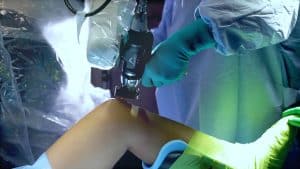 Robotic knee surgery in progress with surgeon using Mako system.